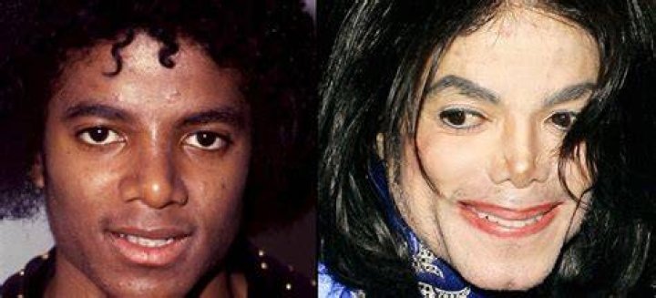 Did Michael Jackson Change His Skin Color? Unveiling the Truth