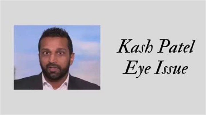 Kash Patel Eye Injury: A Comprehensive Analysis and Insights